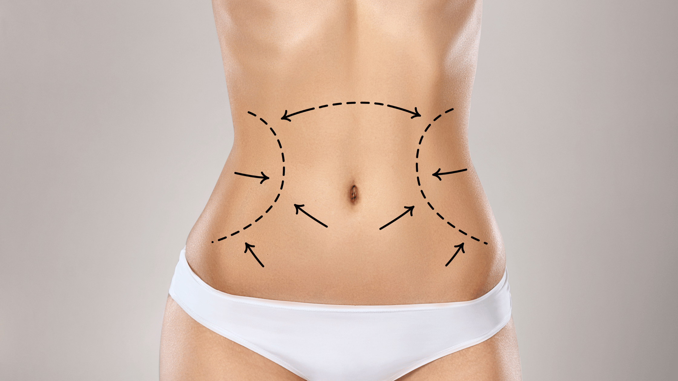 Liposuction